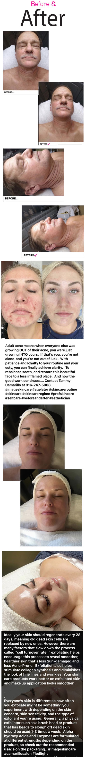 Before & After photos